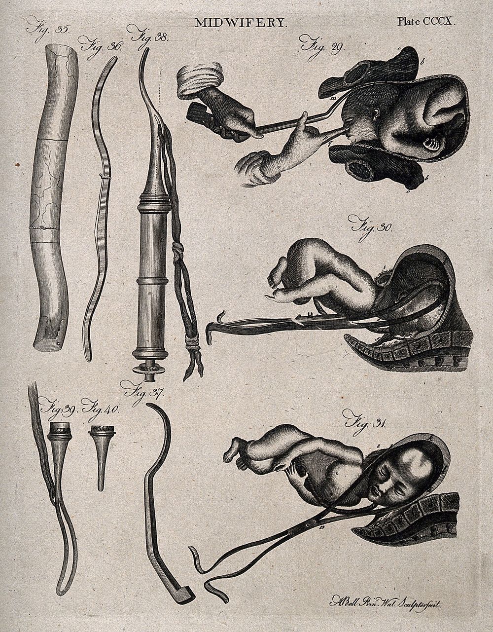 Nine diagrams illustrating breech and natural births and the obstetrical instruments used to assist them. Engraving by A.…
