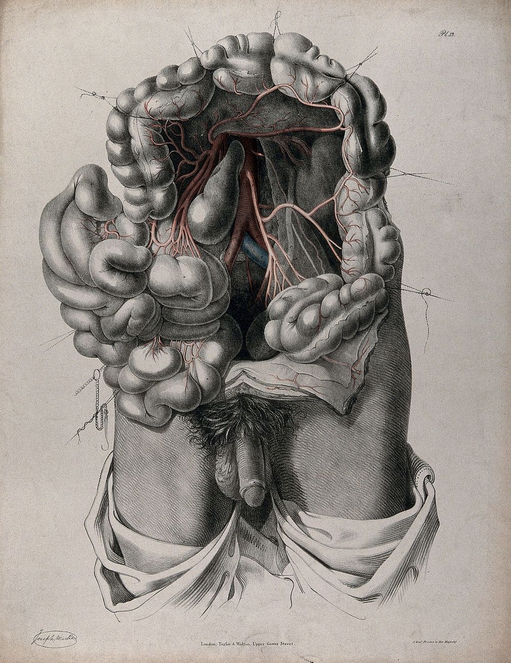 The circulatory system: dissection of the abdomen showing the large intestine, with the arteries and veins indicated in red…