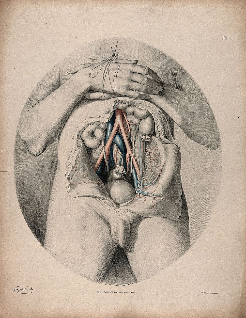 The circulatory system: dissection of the abdomen showing the intestines and bladder, with the arteries and veins indicated…