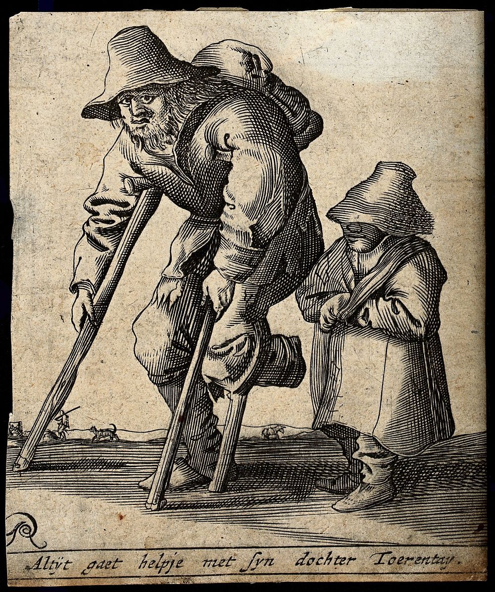 A man with one foot moves with crutches accompanied by a little girl wearing a hat and her arm in a sling. Engraving with…
