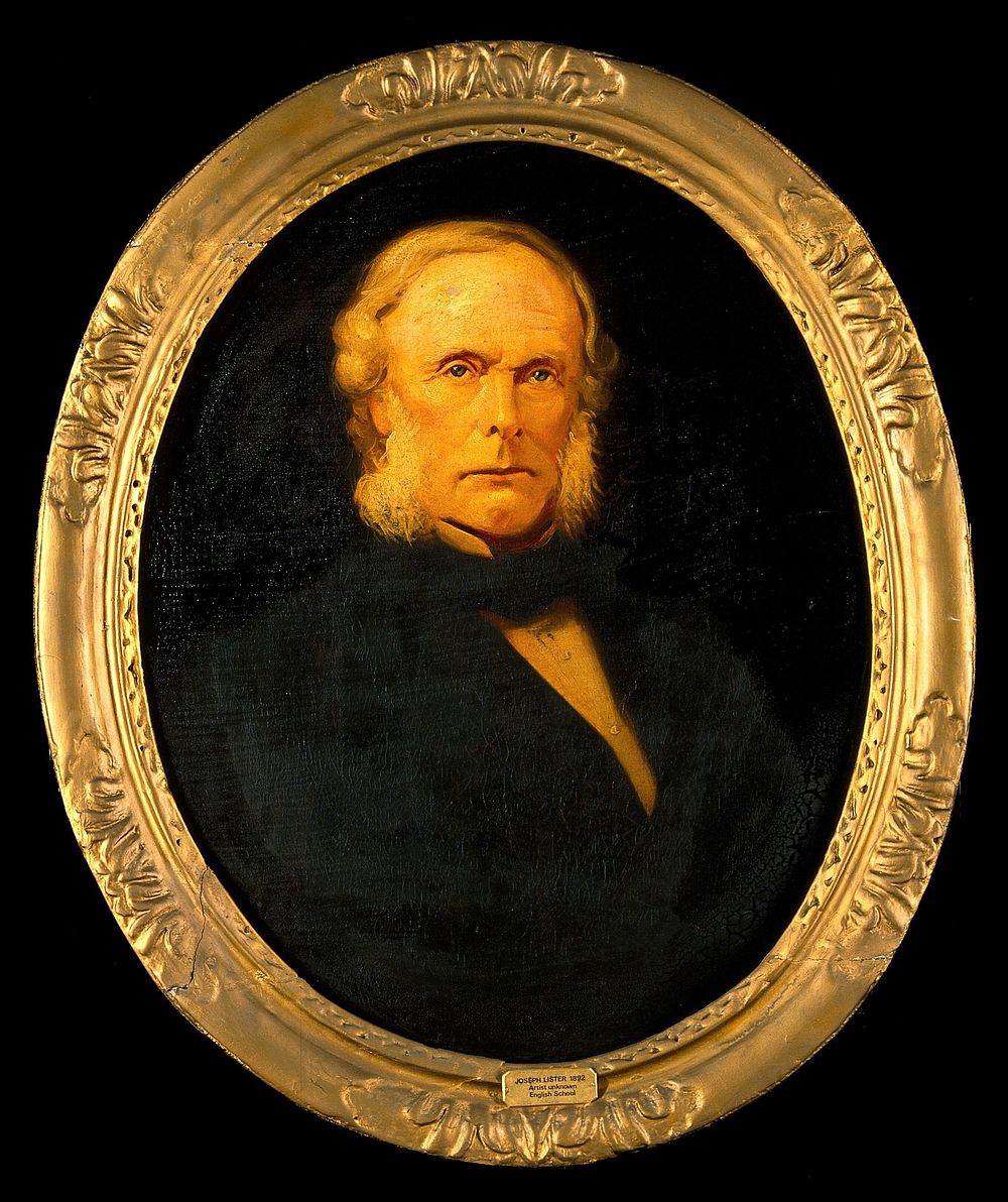 Joseph Lister, 1st Baron Lister. Oil painting.