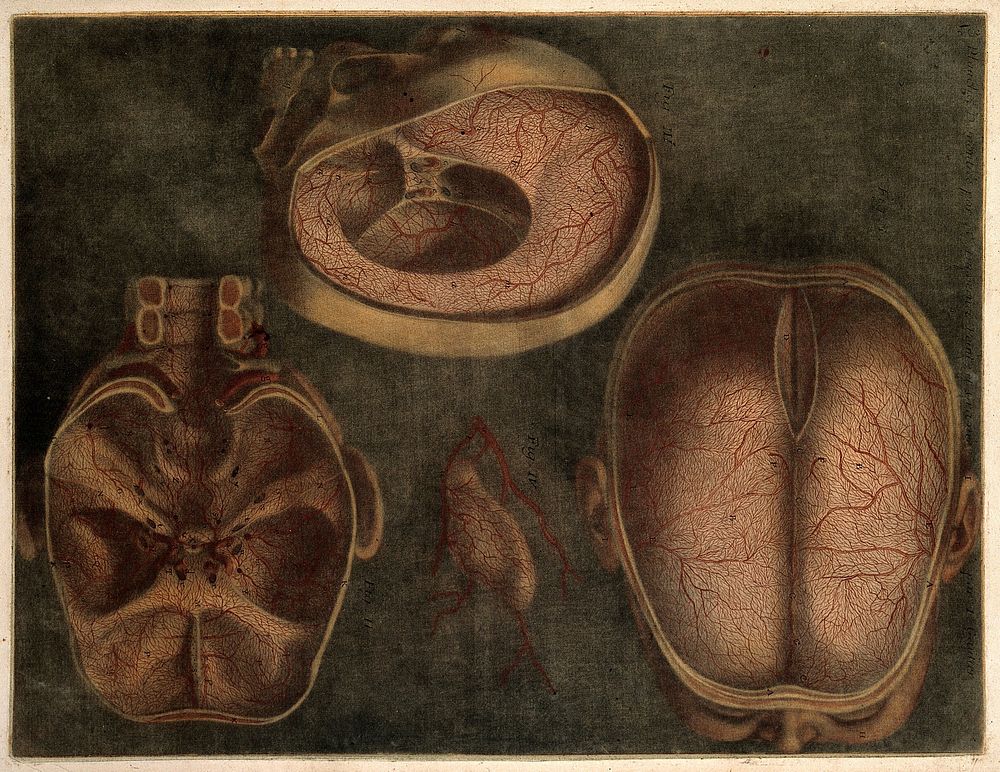 Dissections of the brain and blood vessels: three figures. Colour mezzotint by J.F. Gautier d'Agoty, 1748.