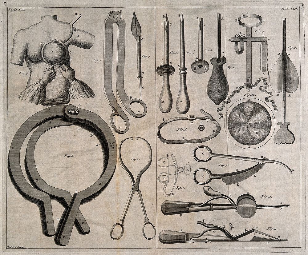 Surgical instruments and a patient having her breast measured. Engraving with etching by R. Parr.
