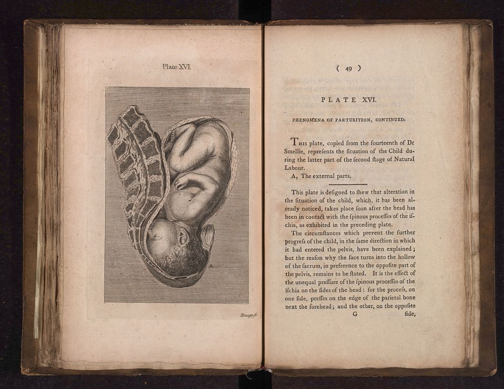 A collection of engravings designed to facilitate the study of midwifery, explained and illustrated / [James Hamilton].