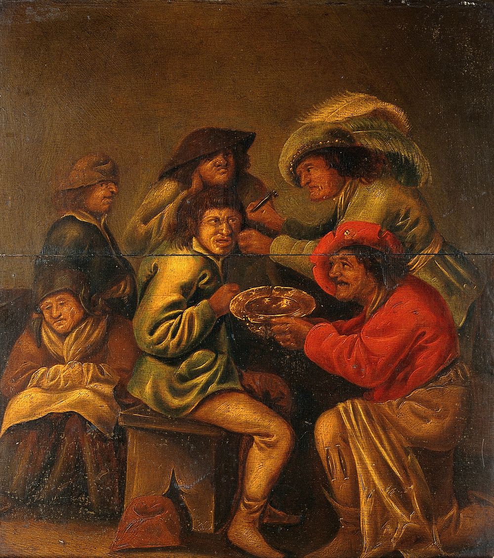 An operator extracting "pierres de tête" from behind a man's ear, with four other people in attendance. Oil painting by a…