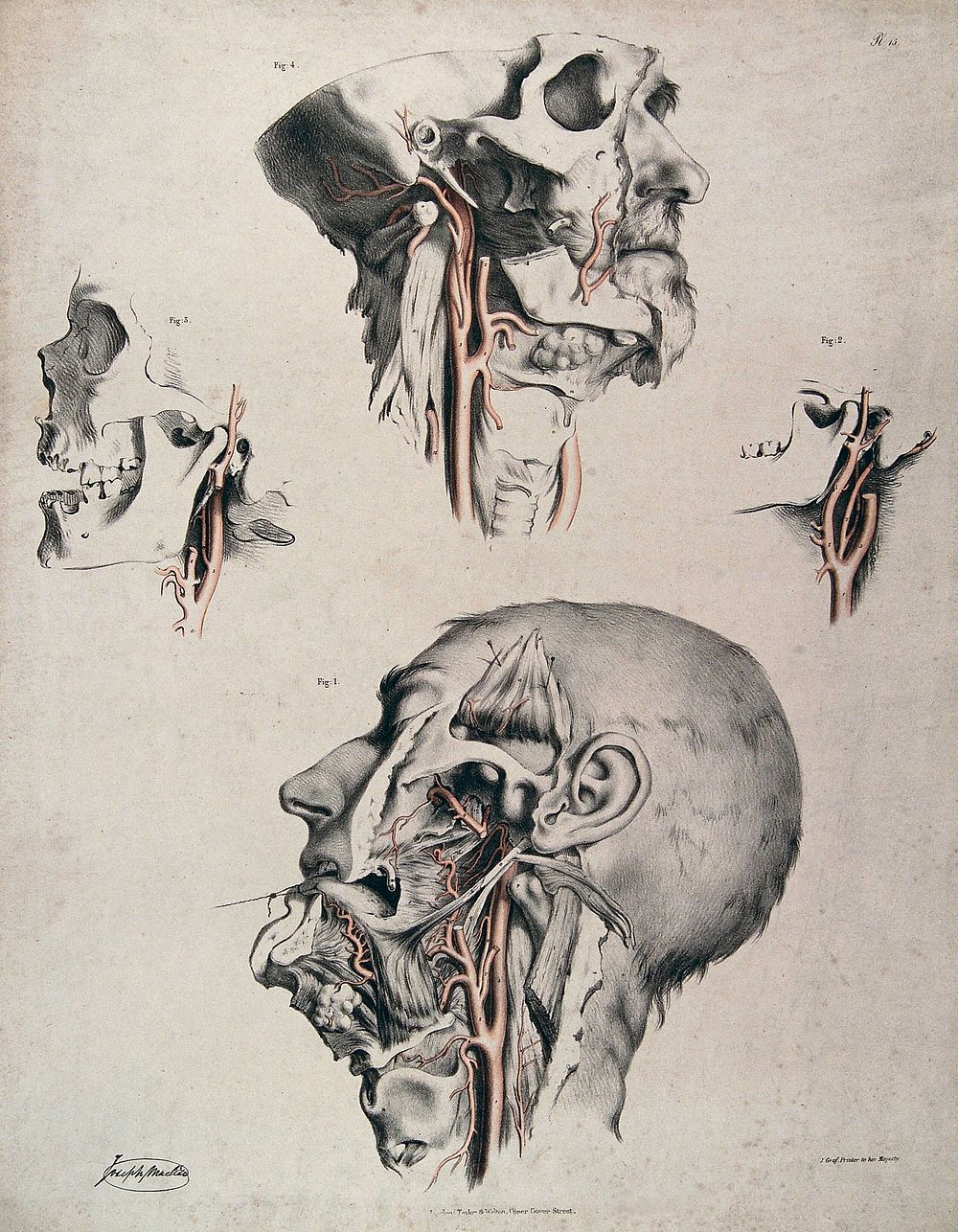 The circulatory system: four dissections of the male face, neck and skull, with arteries and blood vessels in red. Coloured…