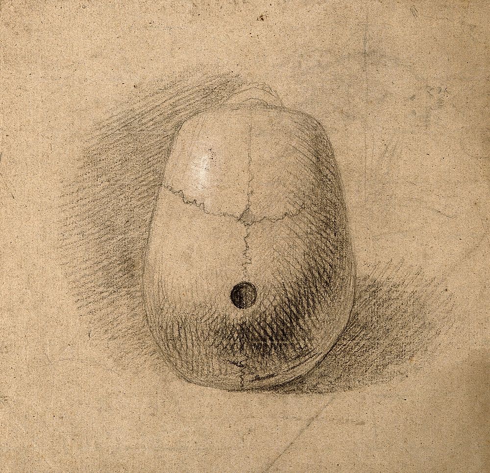 Skull, seen from above: Hole in sagittal suture. Pencil and chalk drawing by C. Landseer, or a contemporary, ca. 1815.