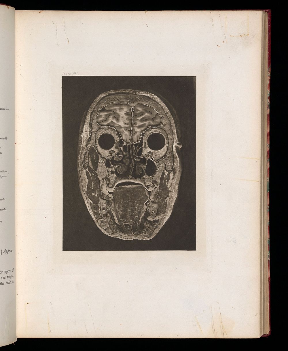 Atlas of head sections : fifty-three engraved copperplates of frozen sections of the head and fifty-three key plates with…