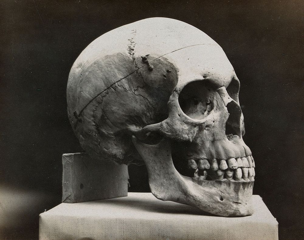 A skull prepared for demonstration: side view. Photograph.