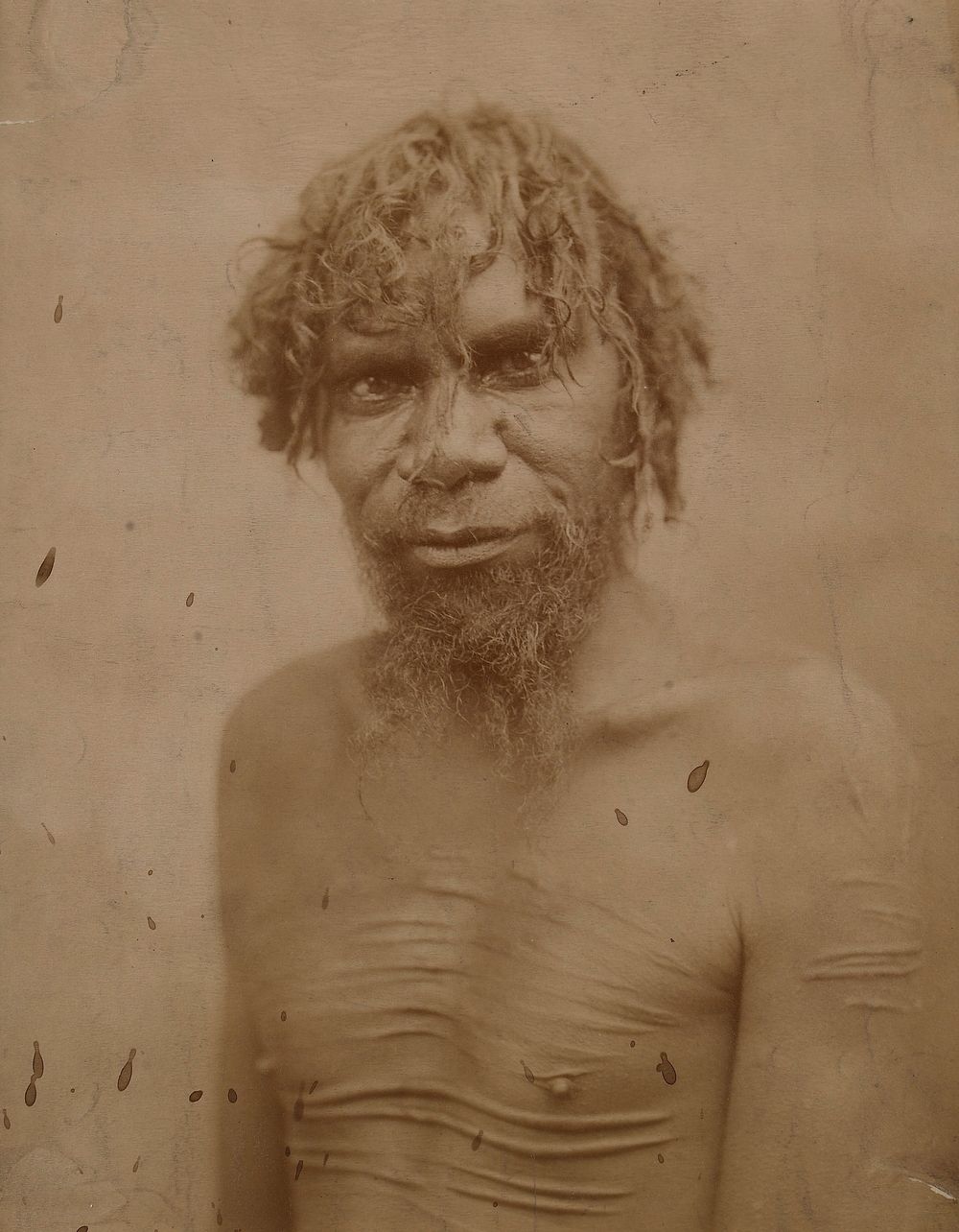 Australian Aborigine with ceremonial scarrification of the torso and arms