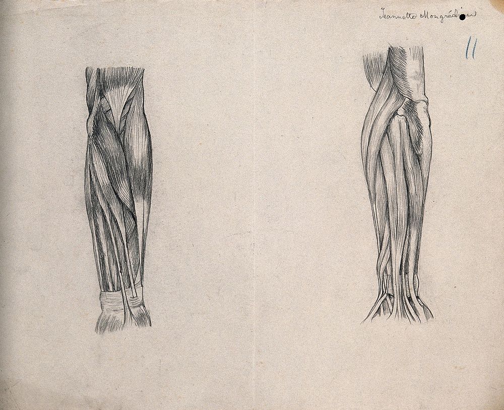 Muscles of the arm []: two figures. Pencil drawing by J. Mongrédien, ca. 1880.