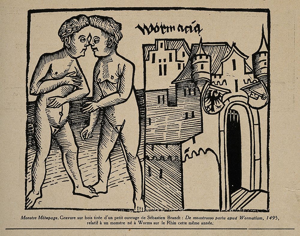 Conjoint twins, joined at the head, born at Worms in 1495. Reproduction of woodcut published in 1495.