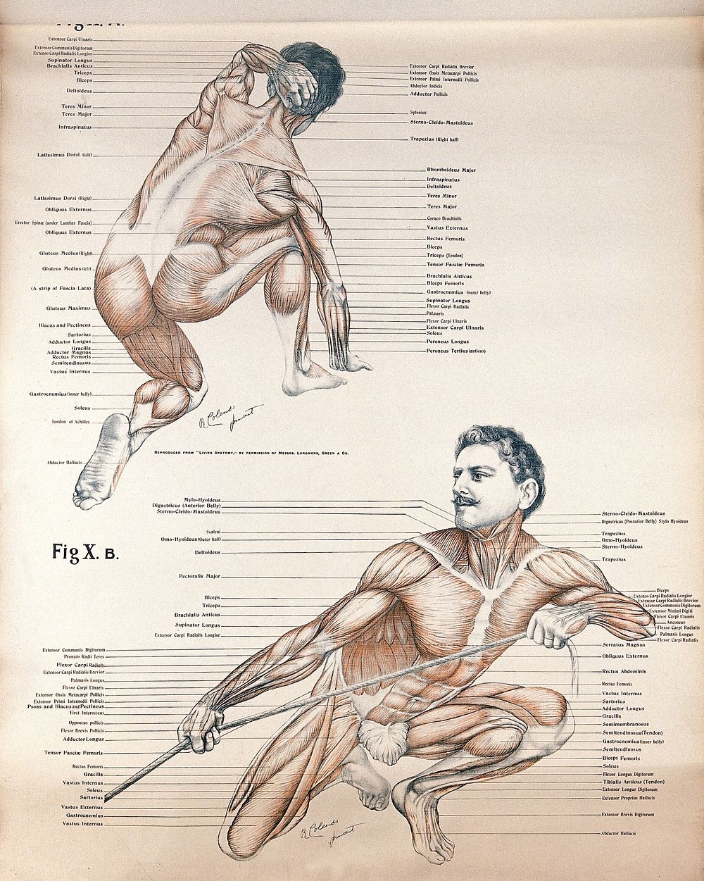 Artistic poses, plate X: two figures of men écorchés. Lithograph by Robert J. Colenso.