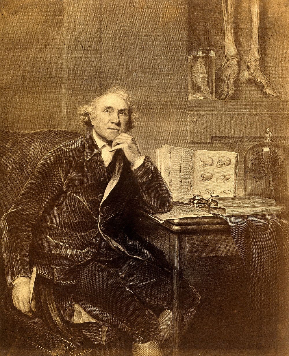 John Hunter. Photograph after Sir Joshua Reynolds.