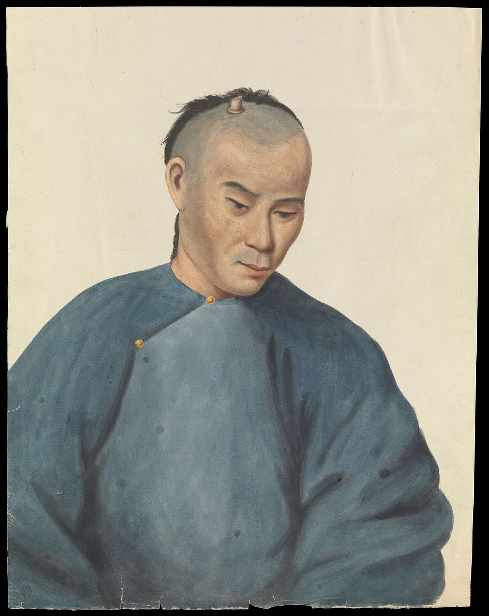 A man with a cutaneous horn-like growth on the scalp. Gouache, 18--, after Lam Qua, ca. 1837.