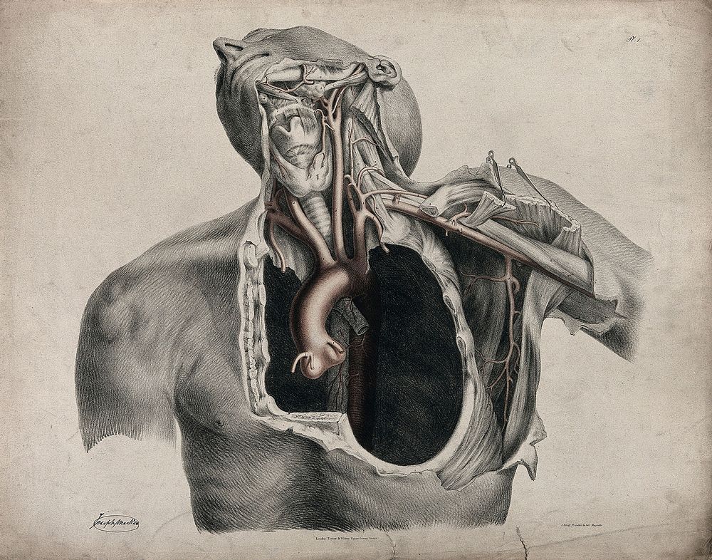 The circulatory system: dissection of the neck, shoulder and thorax of a man, with aorta, arteries and blood vessels…