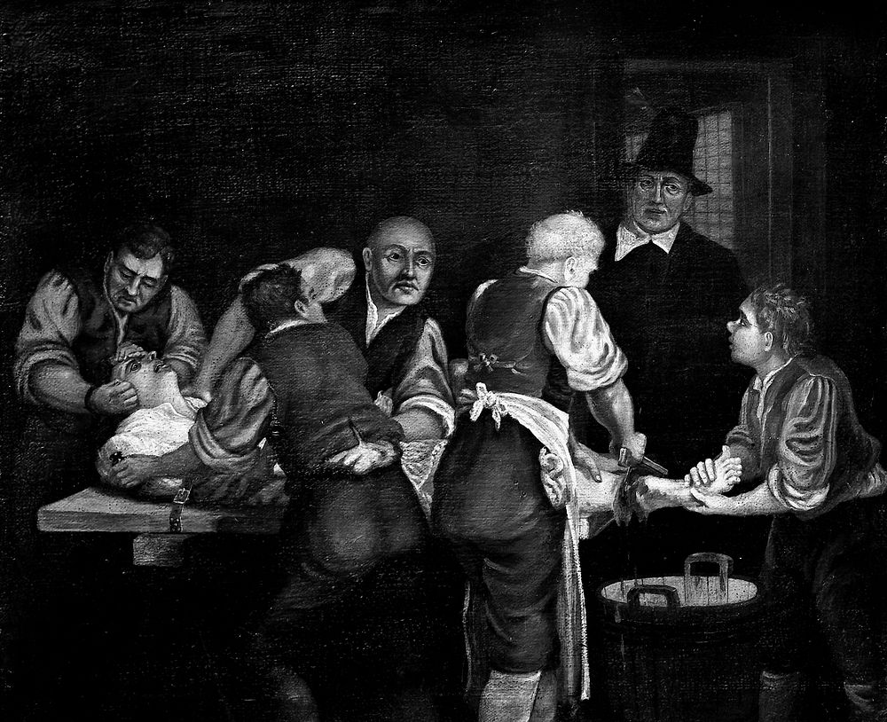 A surgeon performing an amputation of the leg in the seventeenth century. Oil painting, 18-- .