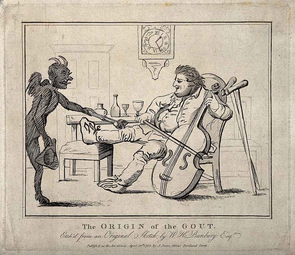 A gouty man drinking wine and playing the cello; the pain is represented by a devil burning his knee. Etching, 1785, after…