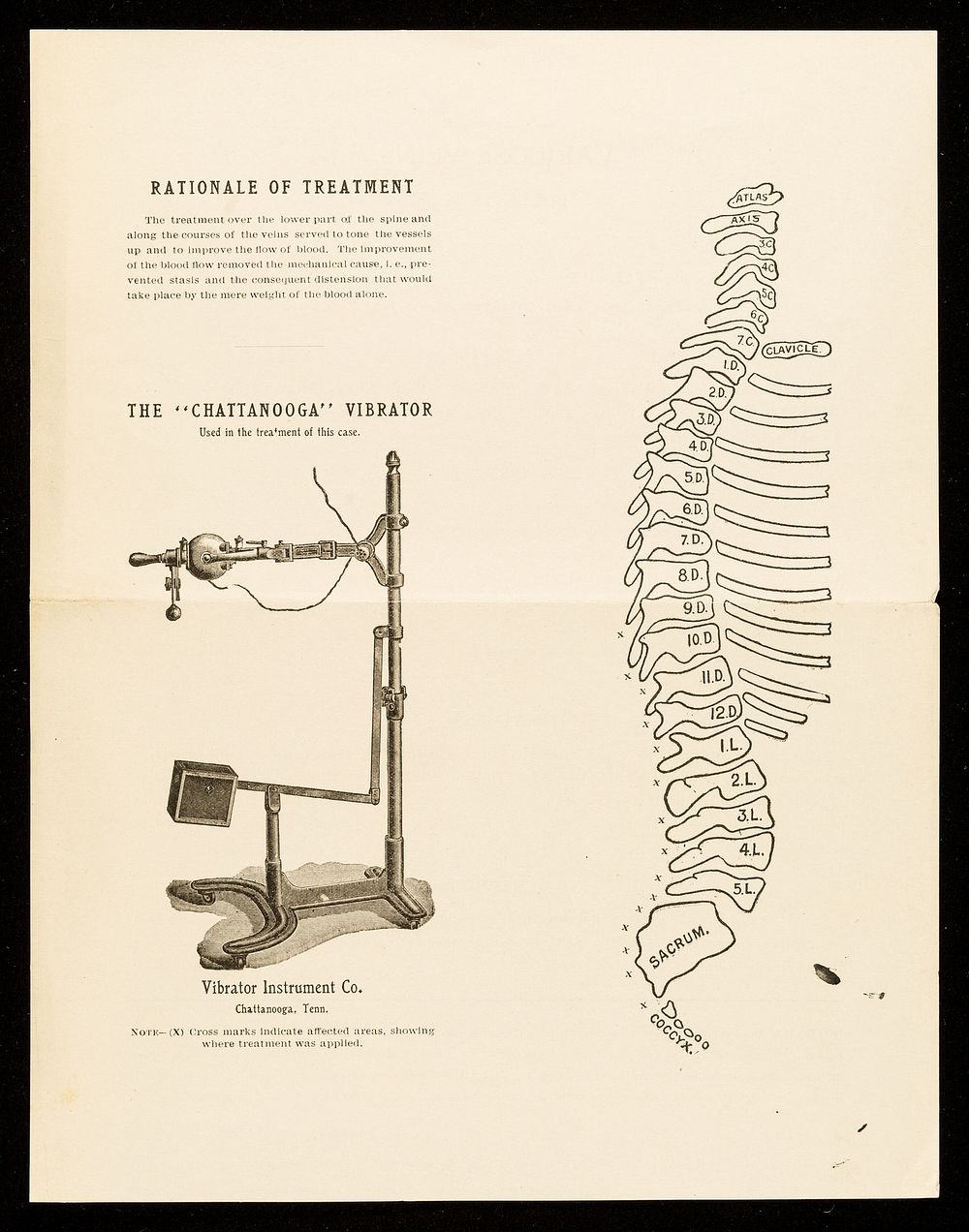 Bulletin. No. 32, Albuminuria / Clinical Department of The Vibrator Instrument Company.