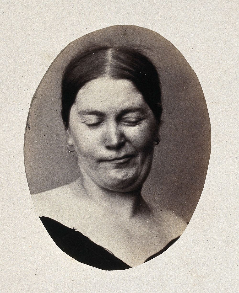 A woman's head and neck; her eyes are closed and her mouth twisted into a grimace. Photograph by L. Haase after H.W. Berend…