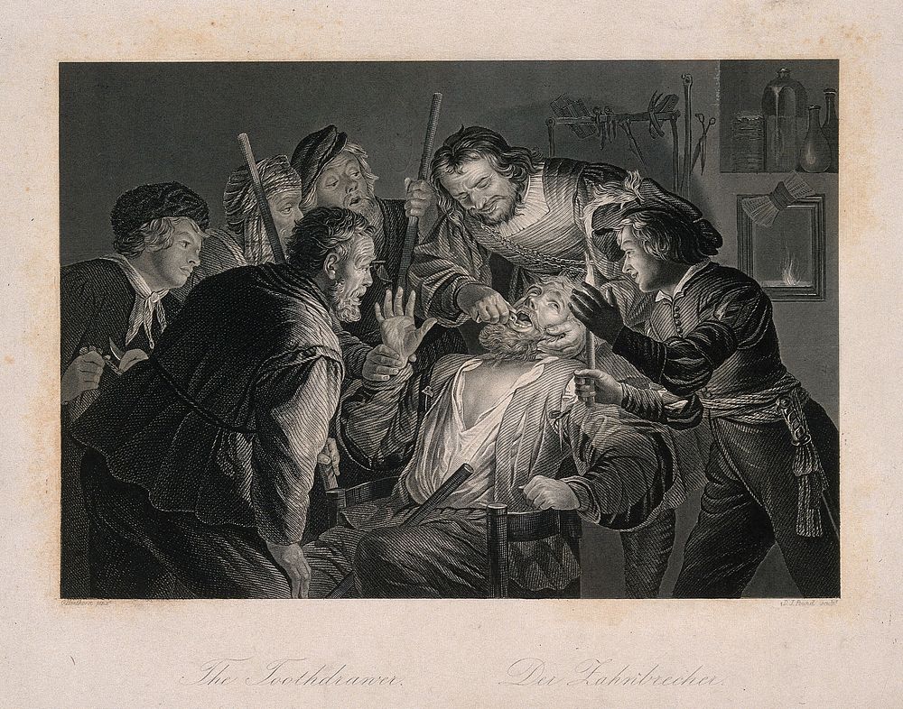 A tooth-drawer in his practice extracting a tooth from a seated patient who is surrounded by friends and family holding…