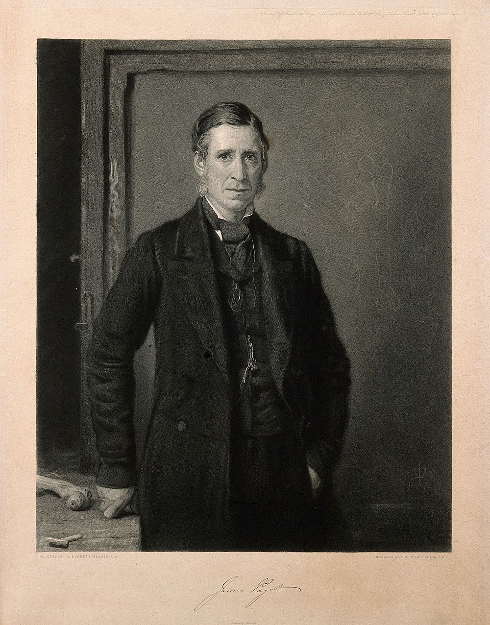 Sir James Paget. Mezzotint by T. O. Barlow after J. E. Millais, 1872.