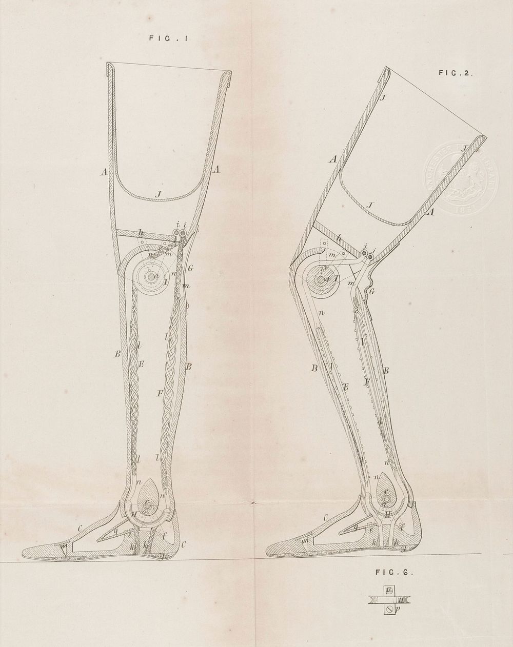 Specification of William Edward Newton : artificial legs.