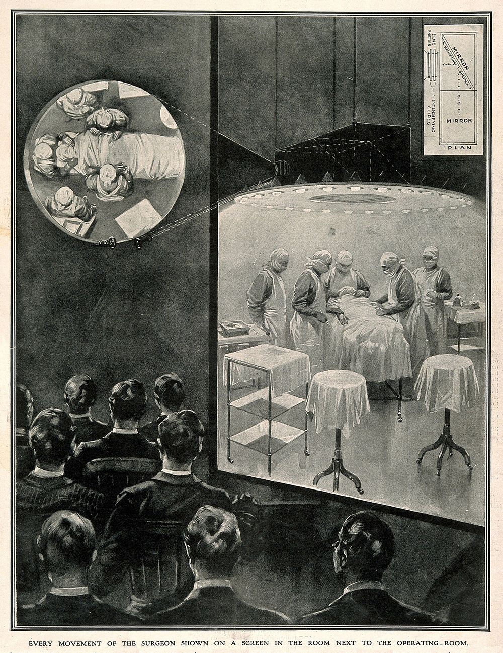 Medical students observing an operation on a lantern screen via a projecting periscope located above the operating table.…