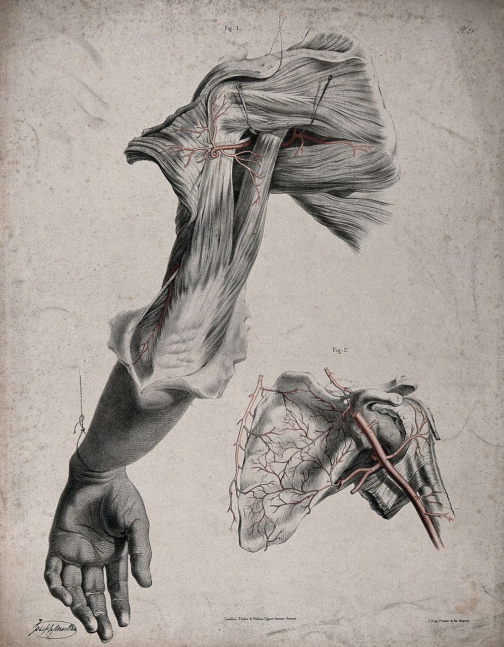 The circulatory system: dissection of the back of the upper arm and the shoulder, with a detail showing the scapula and with…