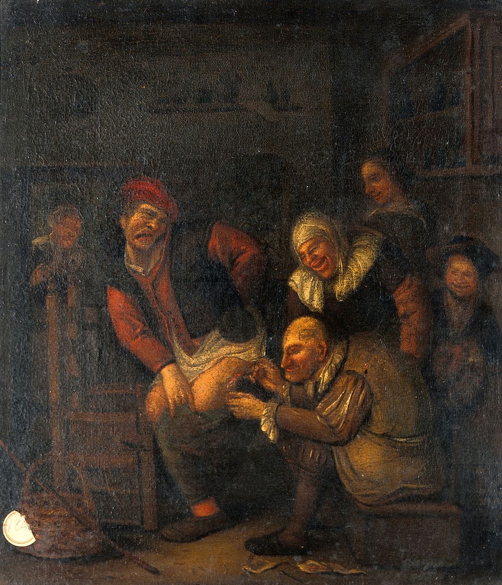 A surgeon operating on a man's thigh. Oil painting.