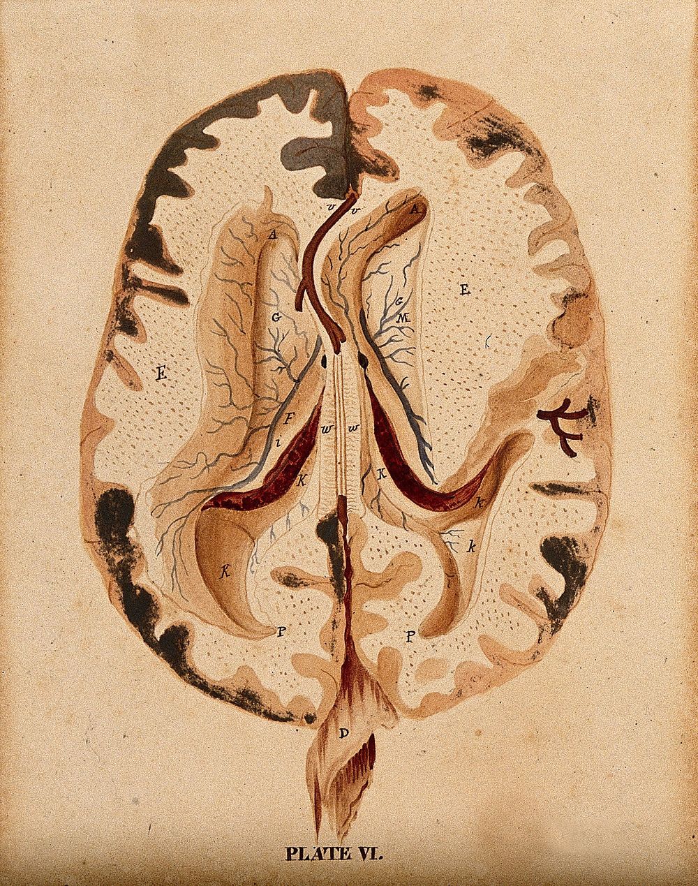 Brain: horizontal section showing lateral ventricles. Watercolour after W.H. Lizars, ca. 1826.