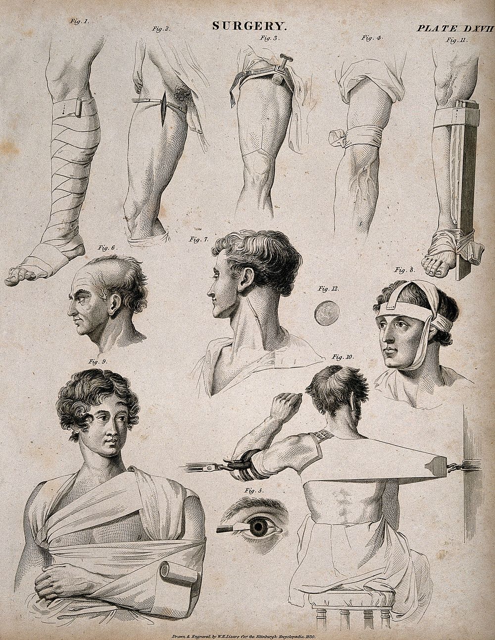 Diagrams illustrating: five bandaged legs (three with different sorts of splints), two heads showing veins, a bandaged head…