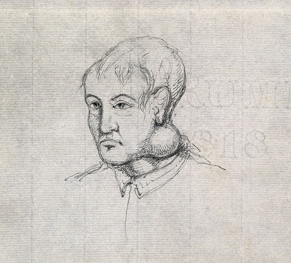 The head and shoulders of a young man, seen in 3/4 profile, with a large swelling on his neck. Drawing, c. 1818 (watermark).