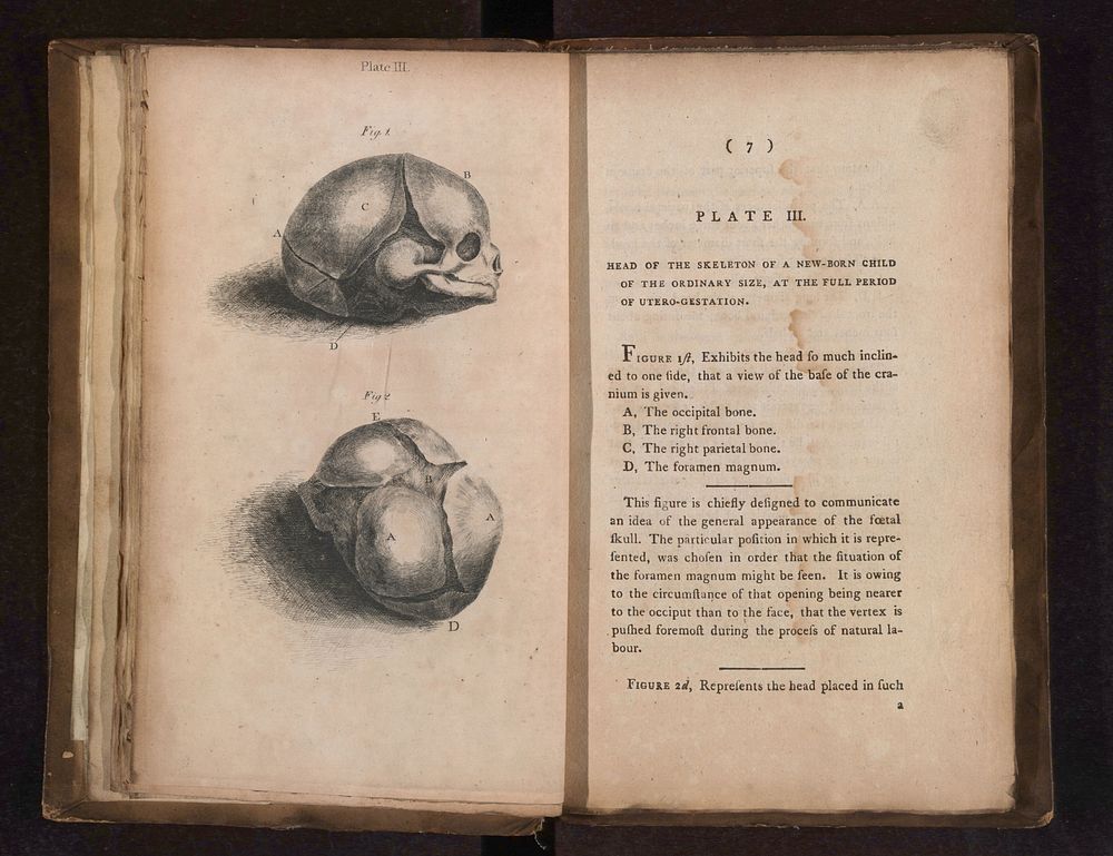 A collection of engravings designed to facilitate the study of midwifery, explained and illustrated / [James Hamilton].