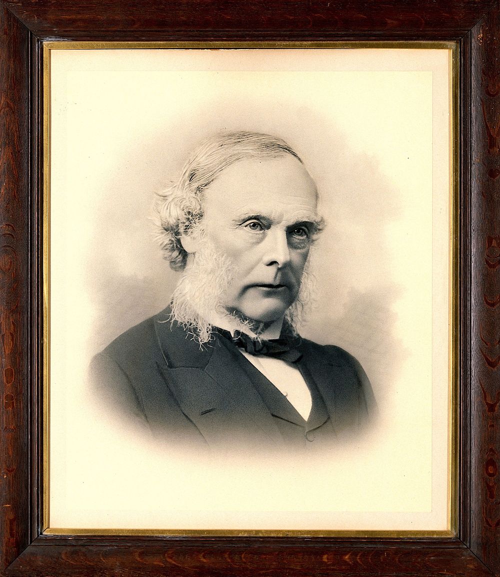 Joseph Lister, 1st Baron Lister. Photograph.