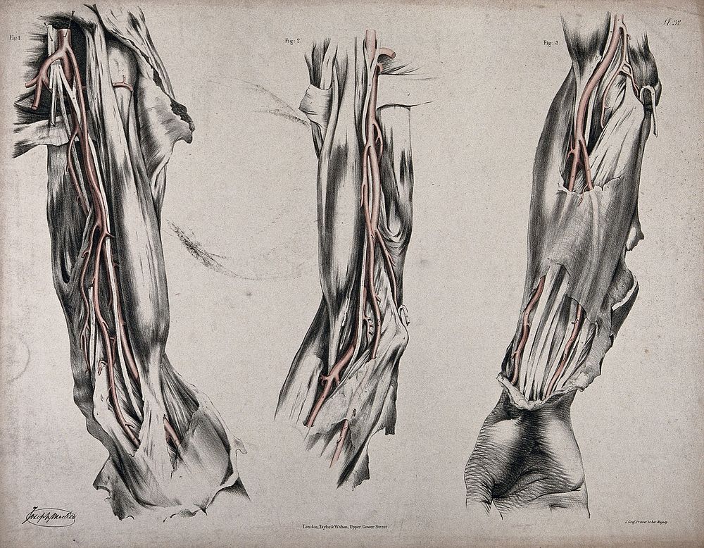 The circulatory system: three dissections of the arm, with arteries and blood vessels indicated in red. Coloured lithograph…