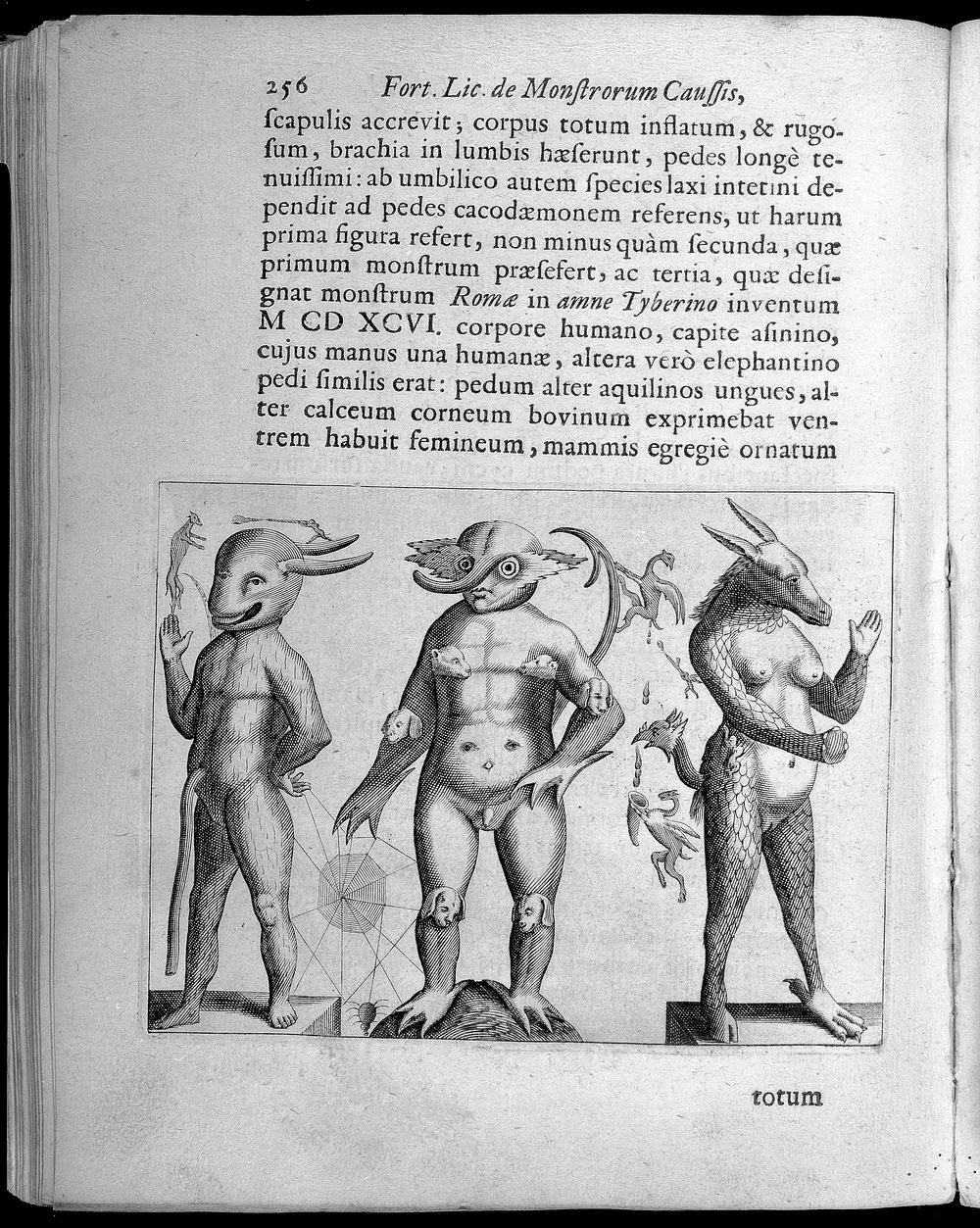 Three figures with abnormalities