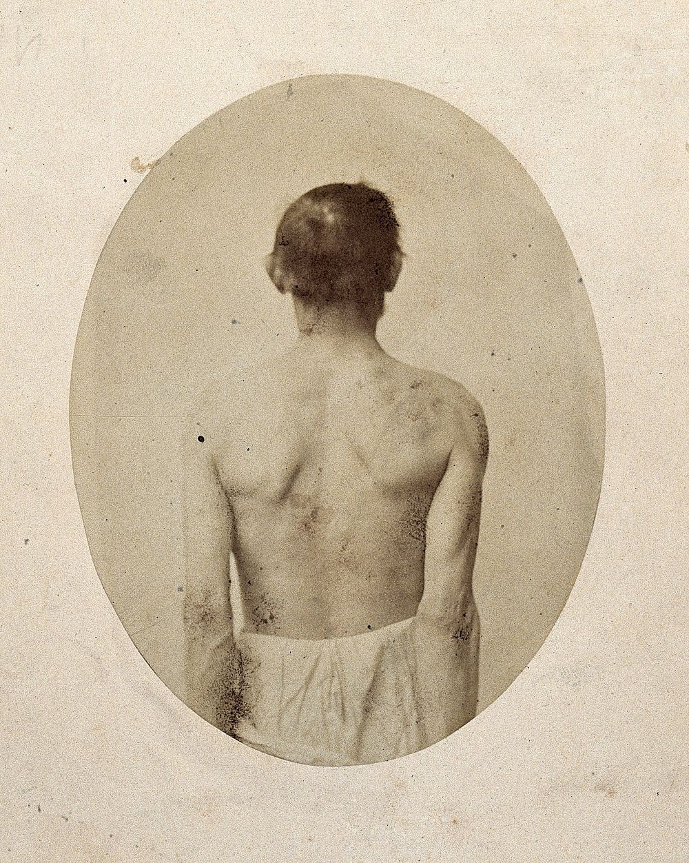 A man, viewed from behind, unclothed to waist with shoulders slightly pushed back. Photograph by L. Haase after H.W. Berend…