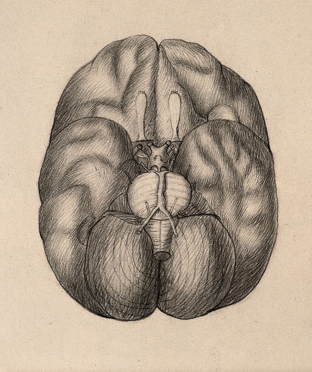 A dissected brain. Drawing.