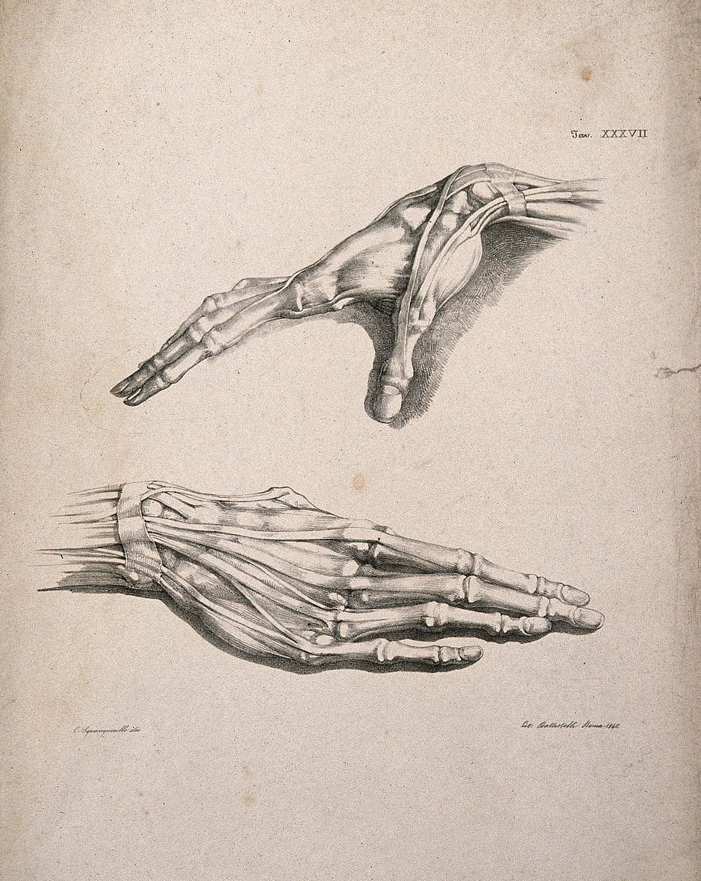 Muscles and tendons of the hand: two figures of écorché hands. Lithograph by Battistelli after C. Squanquerillo, 1840.