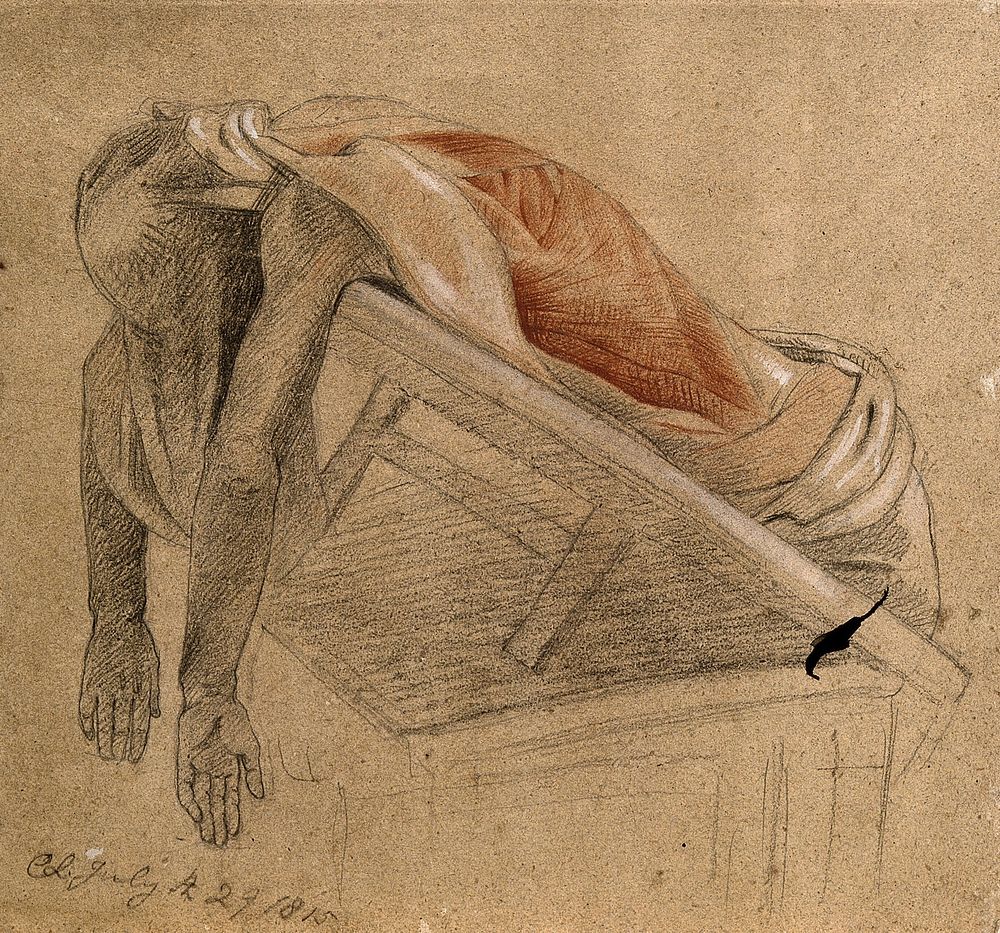 Écorché cadaver resting on tilted support, seen from below, with arms hanging down, with the muscles of the trunk indicated.…