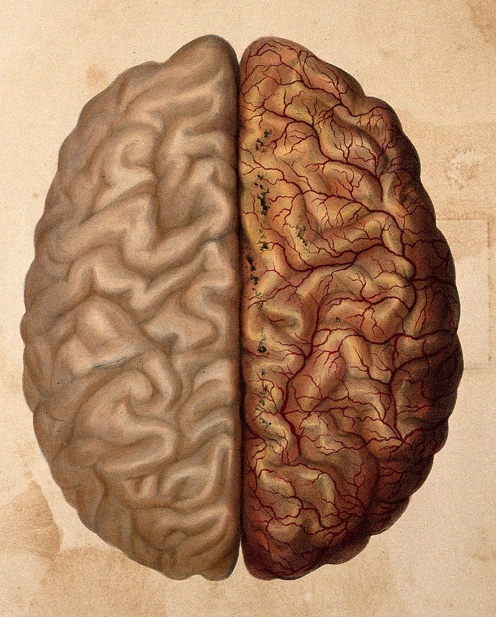 The human brain: the cerebral gyri seen from above, the right hemisphere covered with pia mater. Coloured lithograph by…