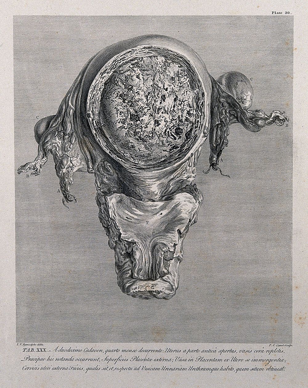 Dissection of the pregnant uterus at five months, showing the placenta and the cervix, in relation to the bladder and…