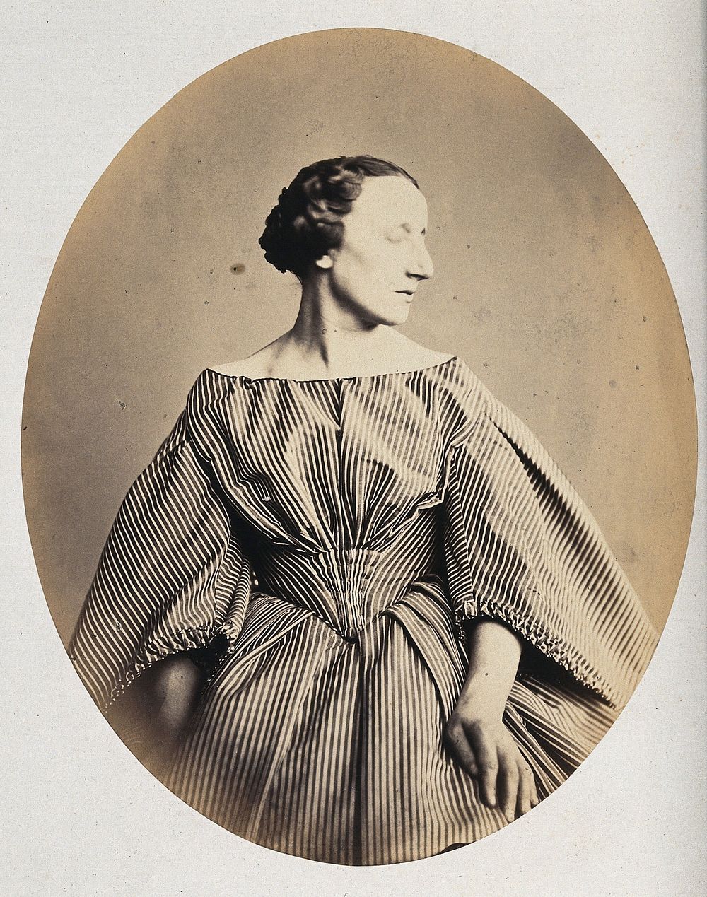 A woman, viewed from the front, with her head tilted toward her left shoulder. Photograph by L. Haase after H.W. Berend…