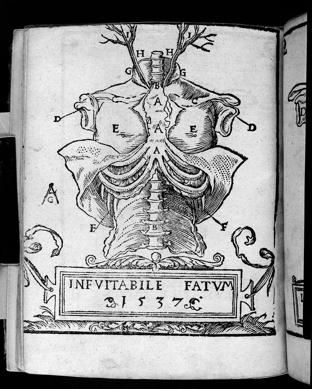 Anatomia Mundini, ad vetustissimorum, erundemque [sic] aliquot manu scriptorum, codicum fidem collata, justoque suo ordini…
