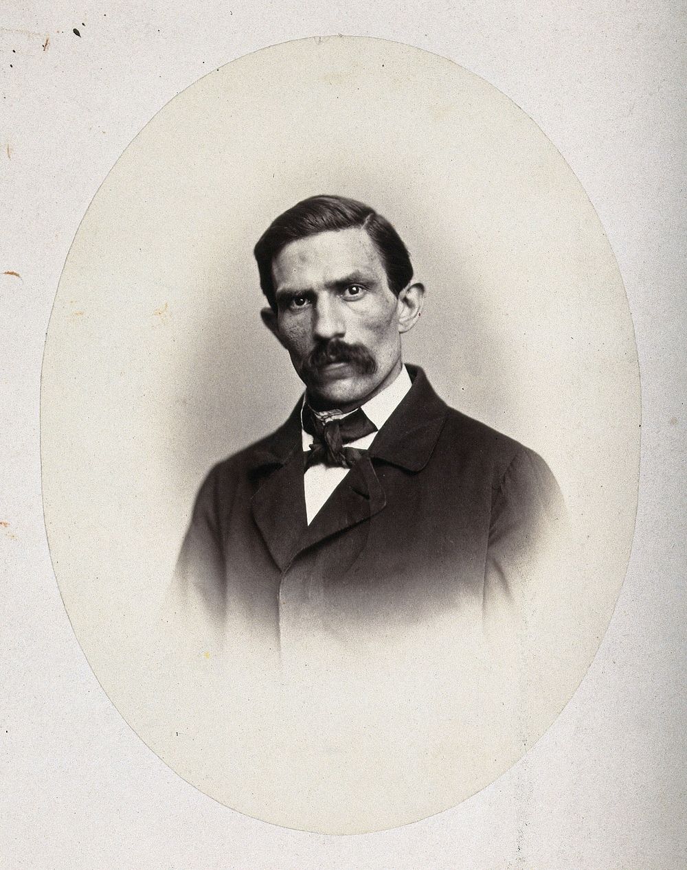 A man, head and shoulders. Photograph by L. Haase after H.W. Berend, c. 1865.
