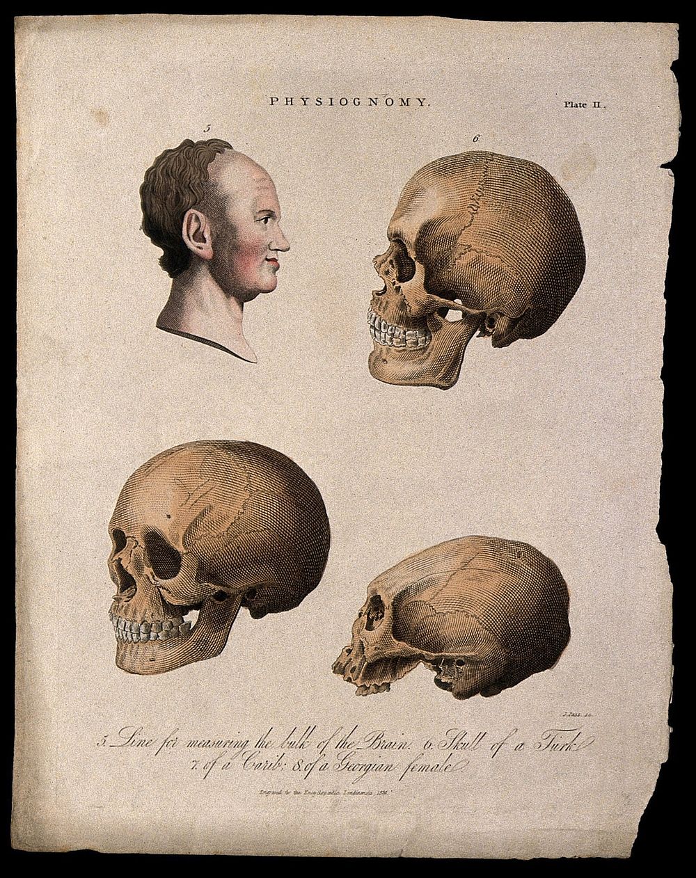 A profile of a man bisected with a curve for measuring the brain, skulls of a Turk (top right), a Georgian woman (bottom…