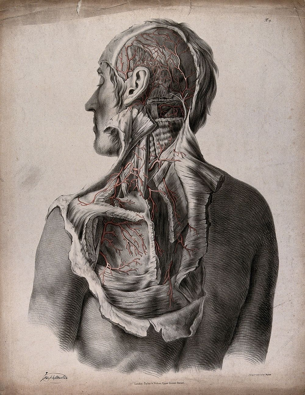 The circulatory system: dissection of the back, shoulder, neck, and back of the head of a man, with blood vessels indicated…