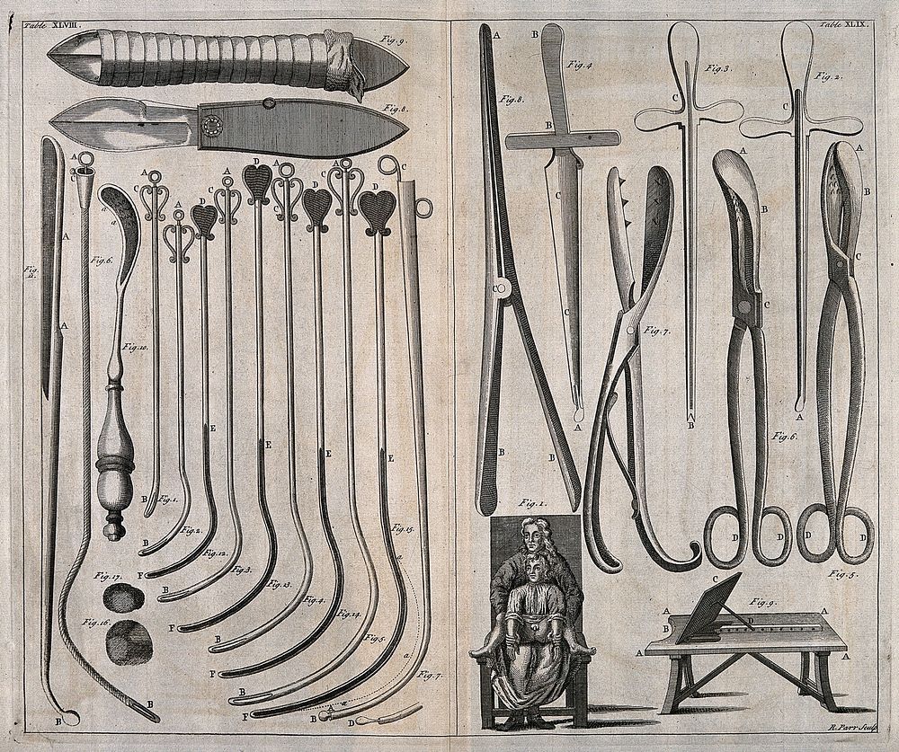 Left, catheters for the treatment of stones and disesases of the urethra; right, a boy held in the right position for the…
