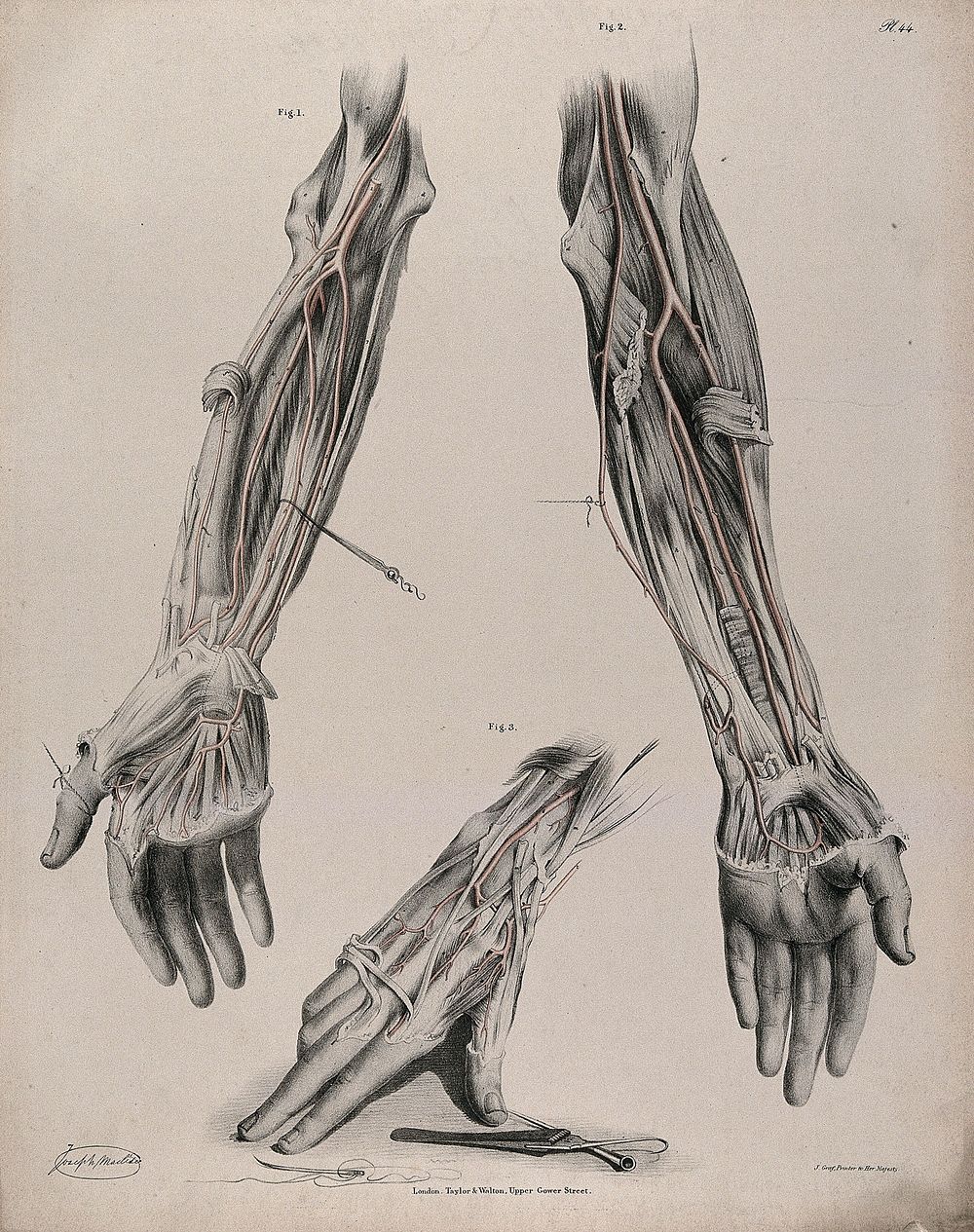 The circulatory system: dissections of the arm and hand, with the arteries indicated in red and surgical instruments shown…